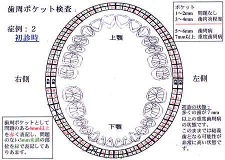 症例2：初診時