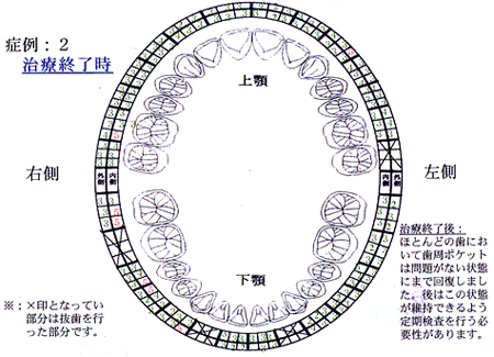 症例2：治療終了後