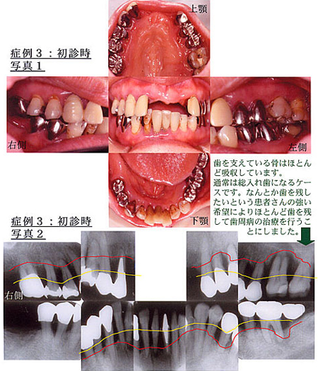 症例3：初診時写真1、症例3：初診時写真2