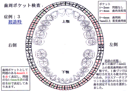 症例3：初診時