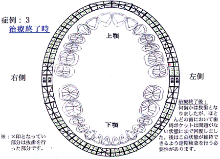 症例3：治療終了後