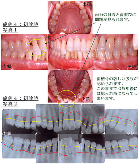 症例4：初診時写真1、症例4：初診時写真2