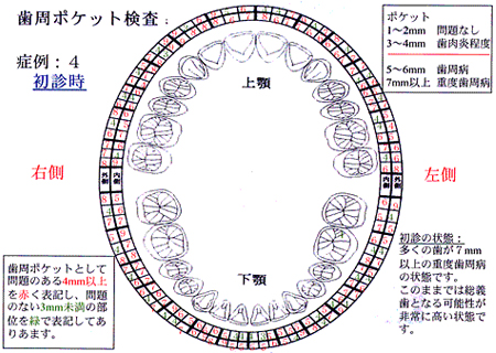 症例4：初診時