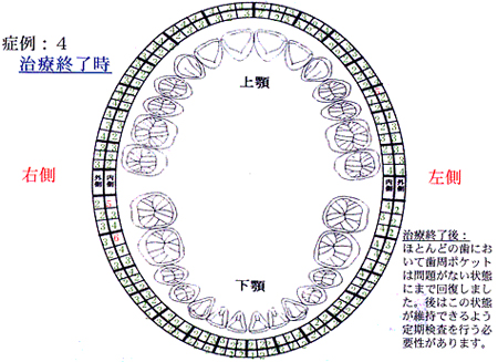 症例4：治療終了後