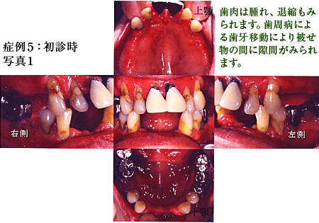 症例5：初診時写真1