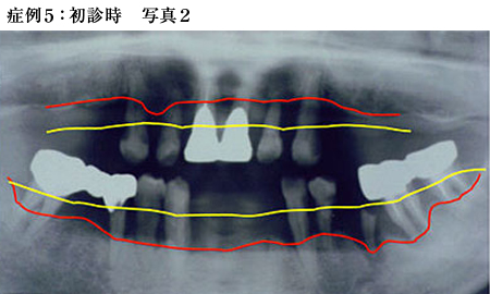 症例5：初診時写真2