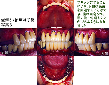 症例5：治療終了後写真3