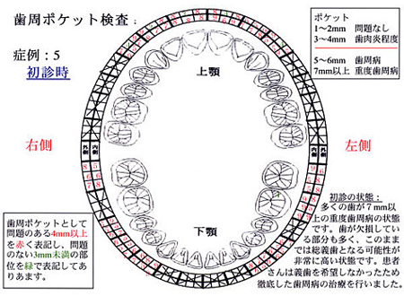 症例5：初診時