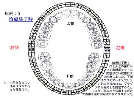 症例5：治療終了後