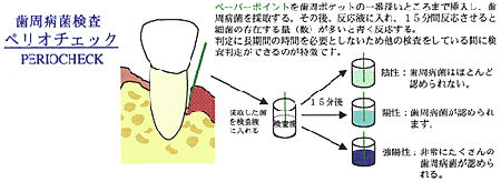 ぺリオチェック